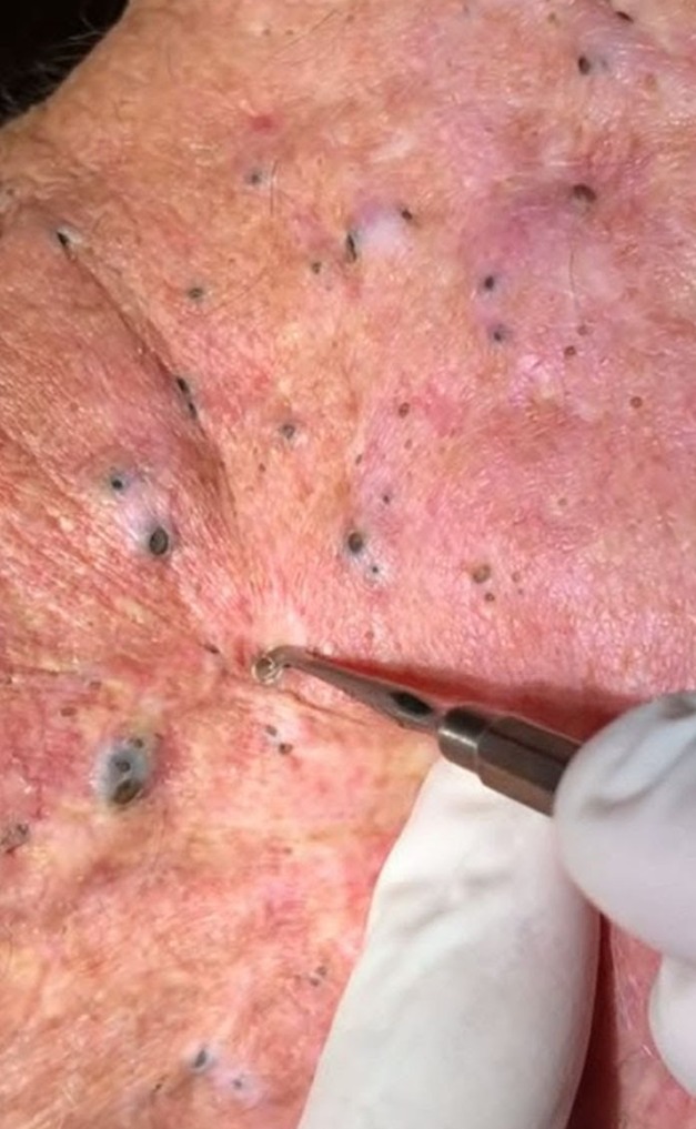 Terror on the Prairie